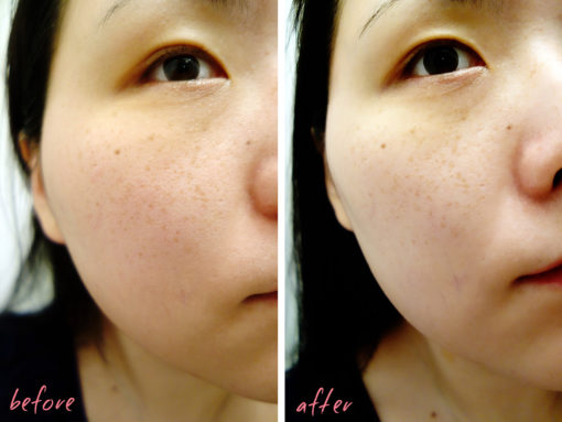 shangpree_bitgoa_hue_essence_toner_before_after